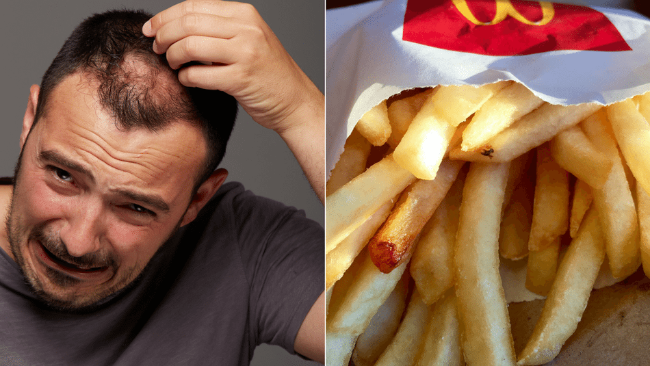 mcdonalds-fries-baldness